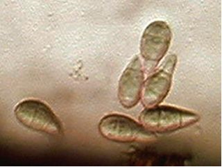 病斑上に胞子(分生子)を多数つくる