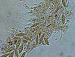 病原菌の柄胞子