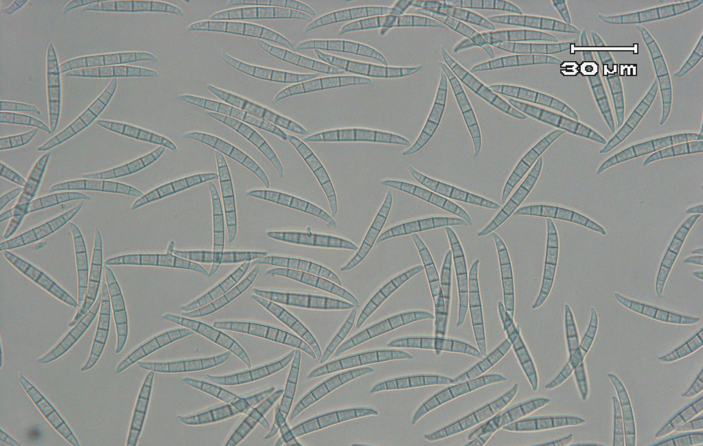 Fusarium graminearum（フサリウム・グラミネアラム）種複合体