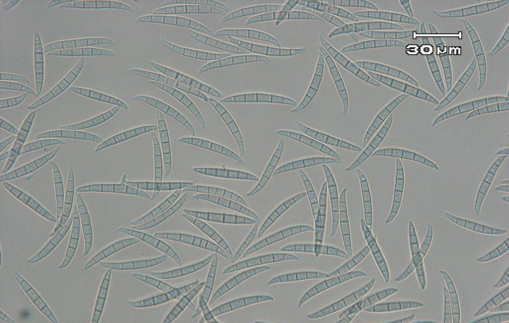 Fusarium graminearum(フサリウム・グラミネアラム)種複合体