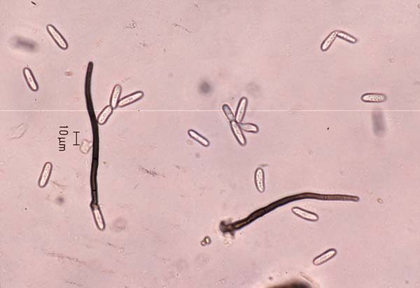 いちご炭疽病菌（グロメレラ シングラータ）の分生子